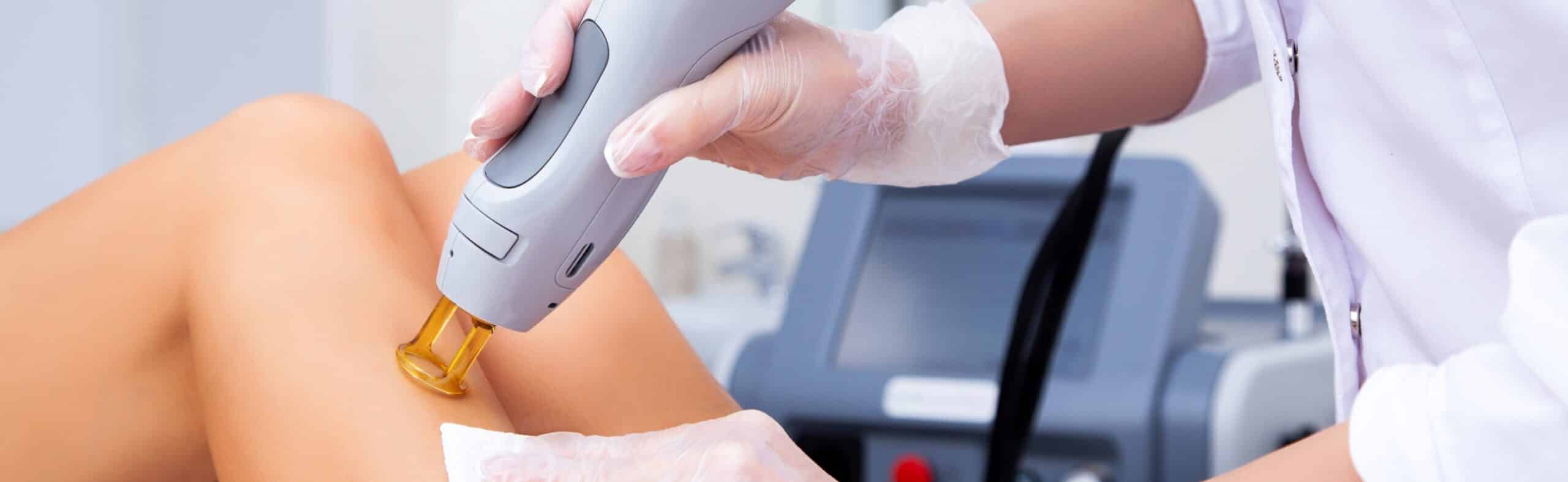 Les avantages de l’épilation laser | Centre ML Esthetics | Paris